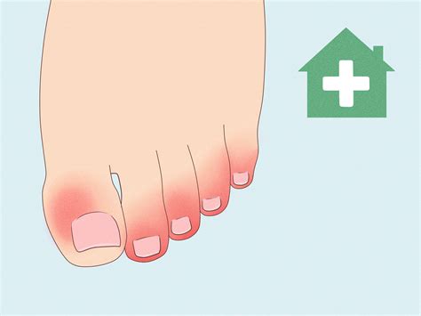 How to Treat Trench Foot: Symptoms & Causes (With Pictures)