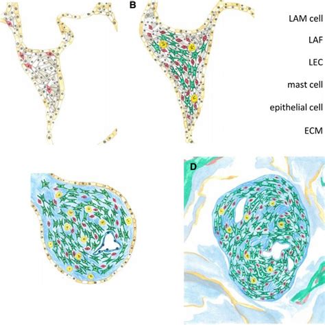 Association of LAM nodule reactivity with lung function and disease... | Download Scientific Diagram