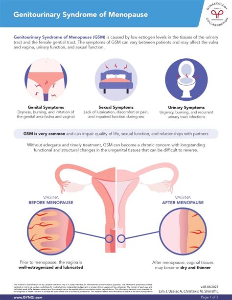 Genitourinary Syndrome of Menopause (GSM) - PDF Download