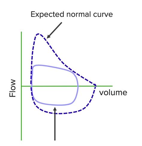 Upper Airway Obstruction Flow Volume Loop