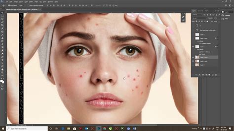 HOW TO REMOVE PIMPLE IN 1 MINUTE IN PHOTOSHOP TUTORIAL - YouTube