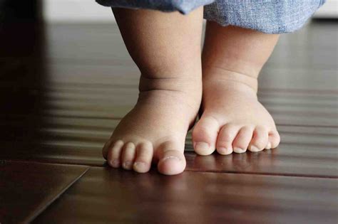 Children's Foot problems - Perform Podiatry