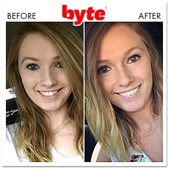 Byte Before & After Photos: Pics of Real Customer Results