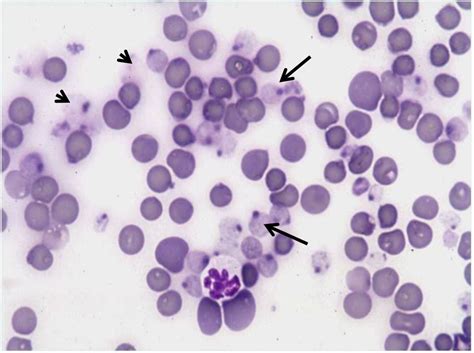 Image:Heinz body hemolytic anemia, cat-Merck Veterinary Manual