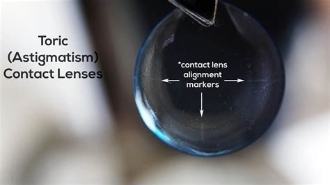 Did you know contact lenses for #astigmatism have little alignment markers for your doctor to ...