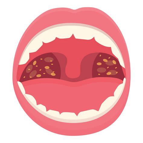 Medical pain mouth icon cartoon vector. Throat health 21524647 Vector ...