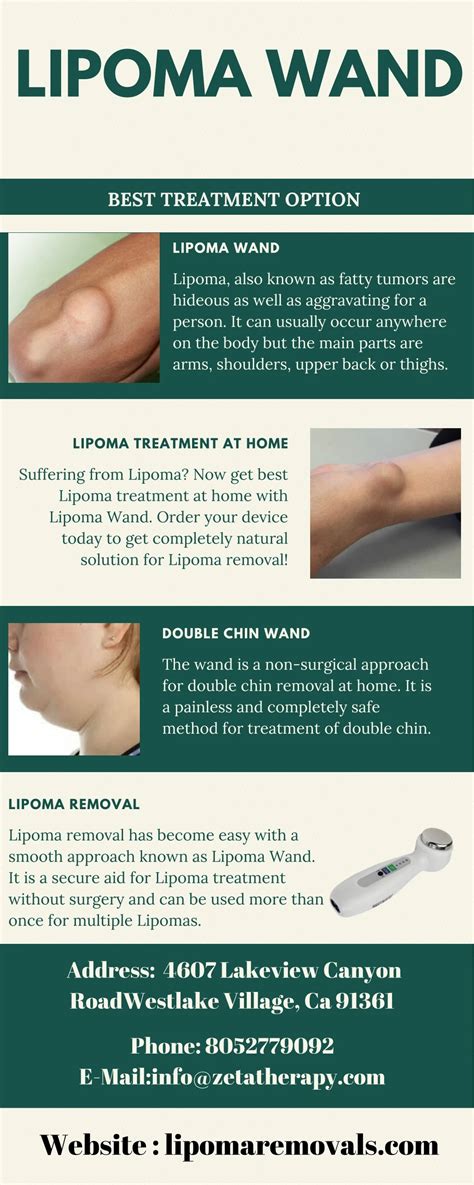 PPT - Shop Lipoma Removals - Lipoma Wand PowerPoint Presentation, free ...