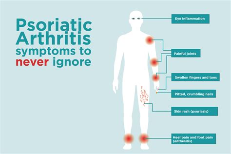 Psoriatic Arthritis Signs and Symptoms