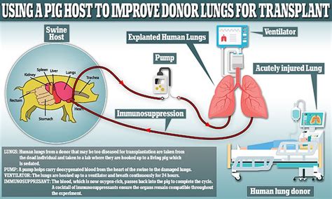 Damaged human lungs can 'mend' if hooked up to living PIG | Daily Mail Online