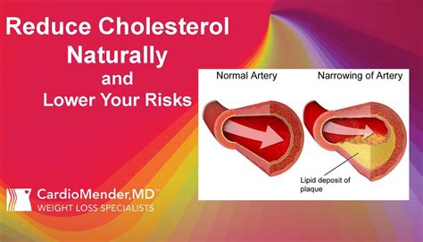 How to Reduce Cholesterol Naturally Using Plant Sterols and Stanols | CardioMender, MD