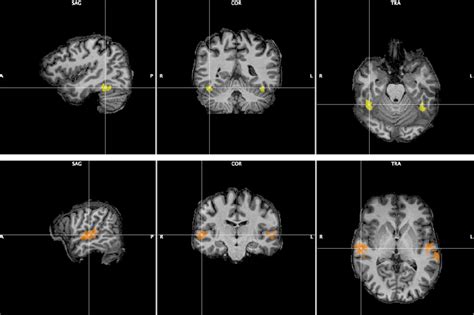 Fusiform Face Area (top row, yellow) and Temporal Voice Area (bottom... | Download Scientific ...