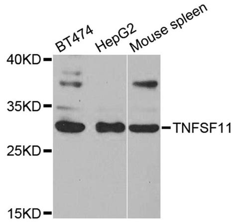 CD254 (RANK Ligand) Antibody (PA5-87147)