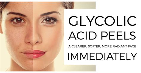 Glycolic Acid 50% Peels | Vigour