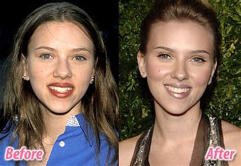 Stars before and after plastic surgery (47 pics) - Izismile.com