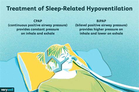 Sleep-Related Hypoventilation: Signs, Causes, Diagnosis