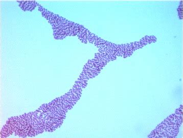 Gram stain of Enterobacter sp. Bisph2. | Download Scientific Diagram