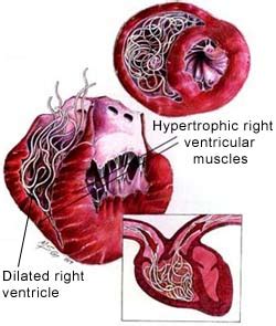 Heartworm Disease and Prevention - Sky Lake Animal Hospital