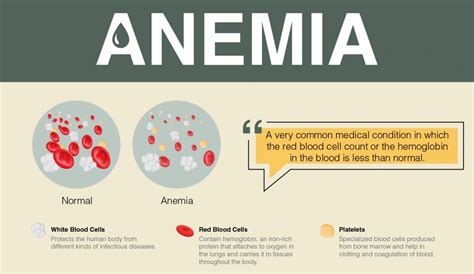 Overview of Anemia: Signs, Symptoms, Causes and Treatment