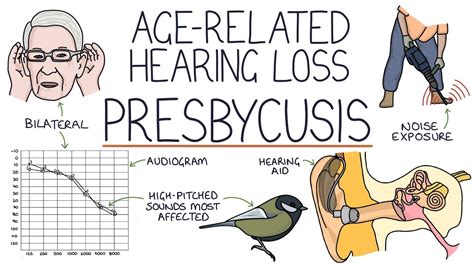 Understanding Presbycusis: Age-Related Hearing Loss - YouTube