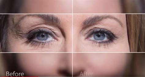 Instantly Ageless™ Before and After Photo Gallery, Jeunesse Global