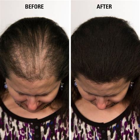 Hair Fibers For Thinning Hair | Hair Thickening Fibers - Infinity