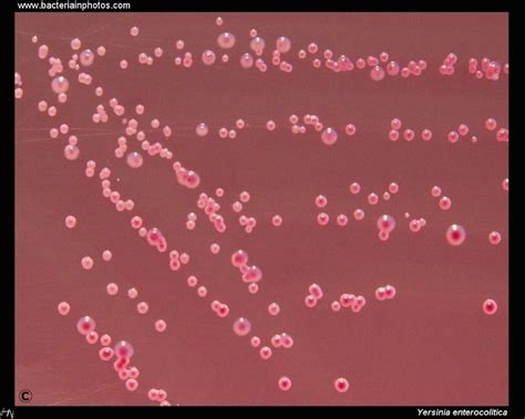 Yersinia enterocolitica colonies on Endo agar