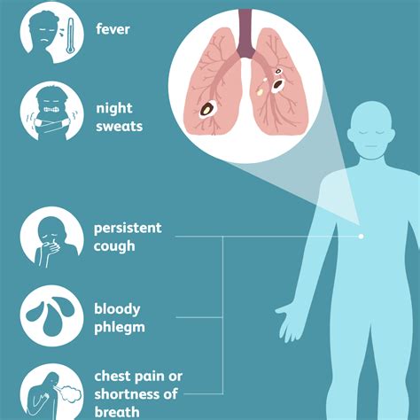 Tuberculosis: Signs, Symptoms, and Complications