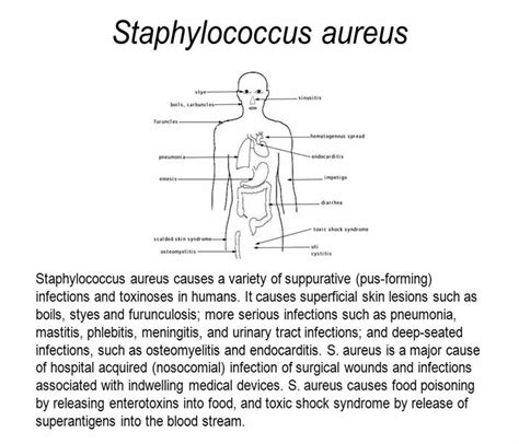 Staphylococcus Aureus Infection Symptoms