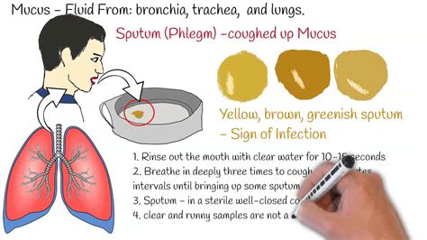 Sputum Test, (Phlegm Analysis), Sputum Culture, Sputum test, Sputum ...