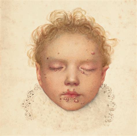 Sick Roses: Disease And The Art Of Medical Illustration | Medical drawings, Medical illustration ...