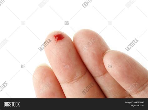 Bleeding Cut Finger Image & Photo (Free Trial) | Bigstock