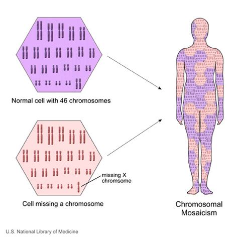 What Does It Mean to Have a Mosaic Form of Klinefelter Syndrome? - StoryMD