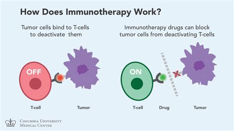 Immunotherapy: New Hope for Patients with Advanced Lung Cancer | Columbia University Irving ...