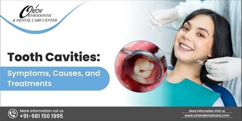 Tooth Cavities: Symptoms, Causes, and Treatments