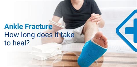 Ankle Fracture : How long does a fractured ankle take to heal?Symptoms ...