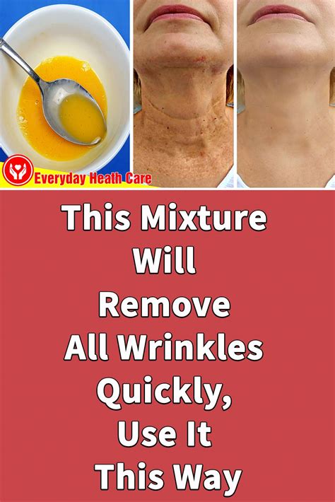 This Mixture Will Remove All Wrinkles Quickly, Use It This Way in 2020 | Wrinkles remedies face ...