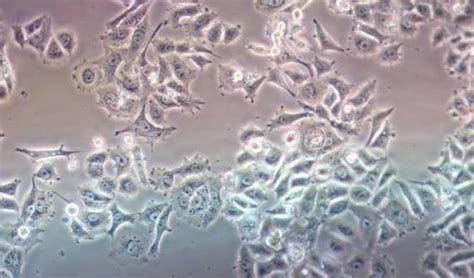 Common contamination and solutions in cell cultures_Cell Culture Technology Column_Technical ...