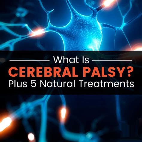 Cerebral Palsy Life Expectancy and Natural Treatments - MKExpress.net