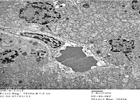 An electron micrograph of zona fasciculata cells from group II showing... | Download Scientific ...