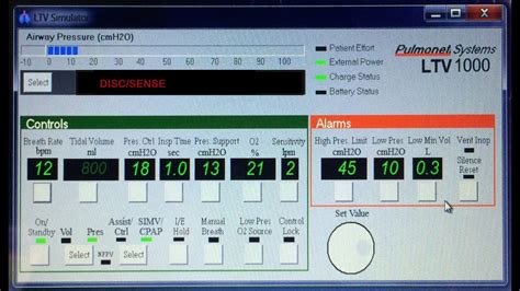 CONTROL BUTTONS: LTV VENTILATOR SETTINGS EXPLAINED - YouTube