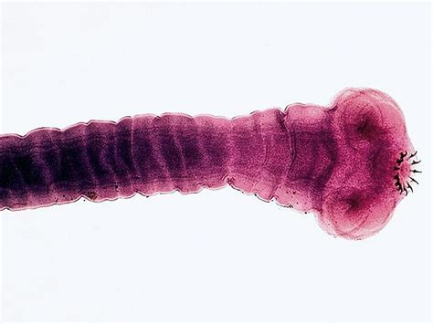 Uninvited Guests: The 7 Worst Parasitic Worms | Britannica