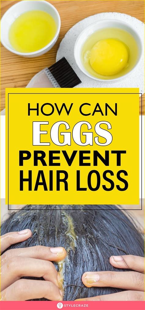 How Eggs Prevent Hair Loss And Aid Hair Growth in 2021 | Prevent hair ...