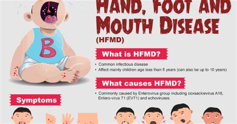 HAND,FOOD AND MOUTH DISEASE