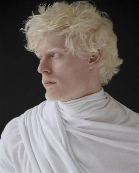 White Out (Schön Magazine) | Albino human, Albino men, Albino model