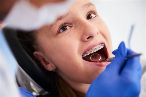 What to Know About Orthodontics | Cockeysville, MD Orthodontist