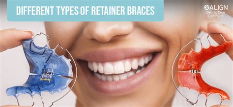 Different types of retainer braces - Best Dental Clinic in Sri Lanka | Dental Clinic in Colombo