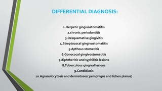 Acute Necrotizing Ulcerative Gingivitis.pptx