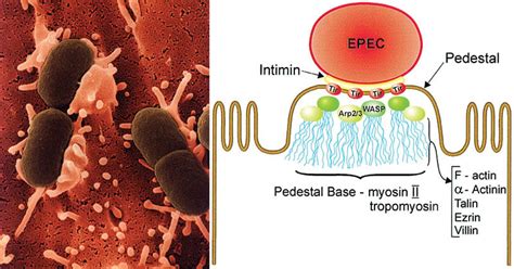 Enteropathogenic Escherichia coli (EPEC)