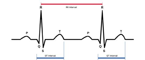 Serious Adverse Effects: Acquired Long QT Syndrome – Biology in Mental Health Nursing