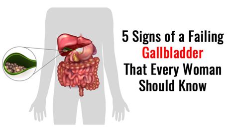 Symptoms Of A Bad Gallbladder In Women